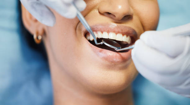 Best Emergency Dental Extractions in Wylie, TX