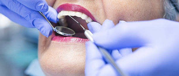 Best Emergency Root Canal Treatment in Wylie, TX
